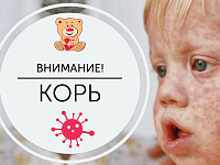Защитите себя и ребенка от кори – «летучей» высокозаразной инфекции
