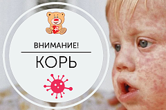  Защитите себя и ребенка от кори – «летучей» высокозаразной инфекции